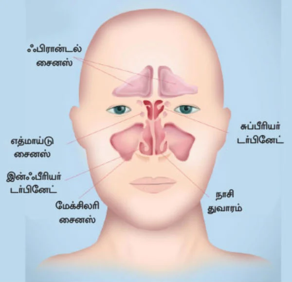 சைனஸ் பிரச்னை தவிர்க்க... தப்பிக்க