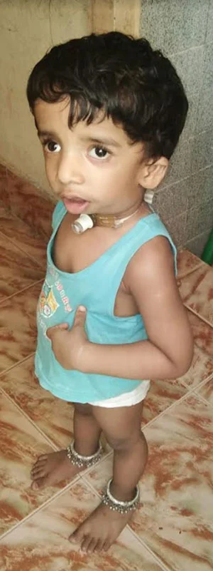 இந்தக் குழந்தைக்கு ஏன் இப்படிப்பட்ட ஒரு கொடுமையான நோய்? #NeedHelp