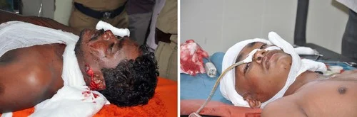 சேலத்தில் பயங்கரம்: காவல்நிலையம் முன் 7 பேருக்கு சராமரி வெட்டு (படங்கள்)