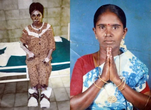 நடை பிணங்களாய் நடமாடும் பட்டாசு ஆலை தொழிலாளர்கள் - நெஞ்சை பிழியும் விருதுநகர் அவலம்
