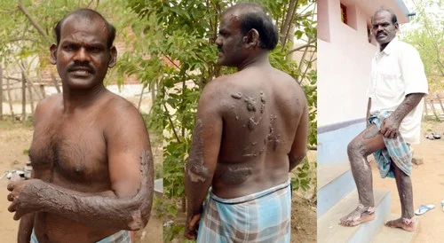 நடை பிணங்களாய் நடமாடும் பட்டாசு ஆலை தொழிலாளர்கள் - நெஞ்சை பிழியும் விருதுநகர் அவலம்