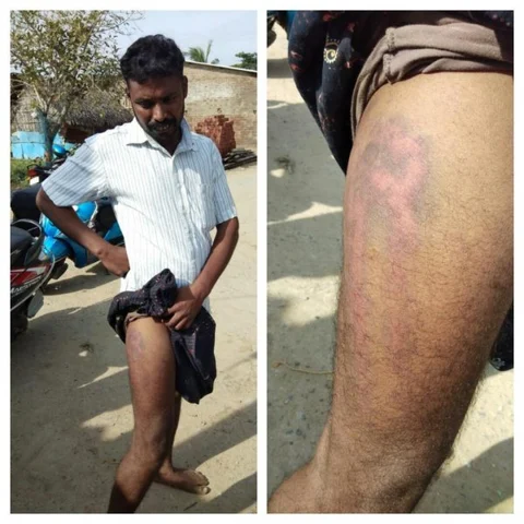 இரும்பு கம்பியால் தாக்கப்பட்ட மீனவர்கள்! - இலங்கை கடற்படை தொடர் அட்டூழியம்