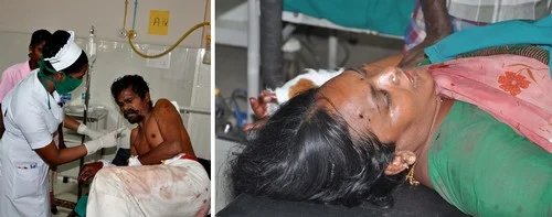 சேலத்தில் பயங்கரம்: காவல்நிலையம் முன் 7 பேருக்கு சராமரி வெட்டு (படங்கள்)