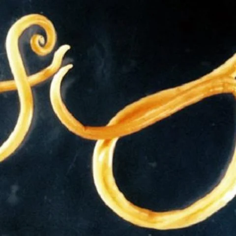 Hookworms - source, impact, tests and treatments