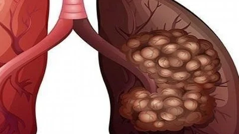 புற்றுநோய் ஏன், எப்படி..? தவிர்க்கும் வழிமுறைகள்!
