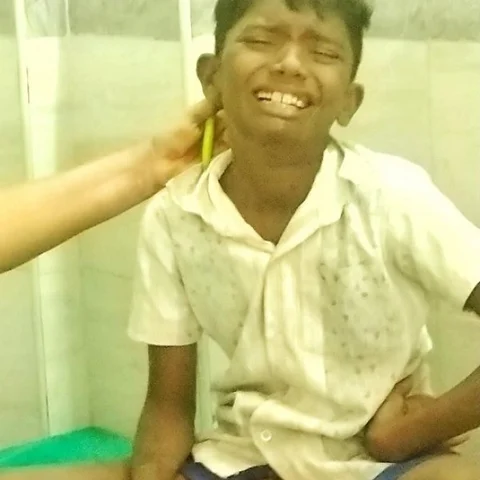 பட்டம் விடும் நூலை விழுங்கிய சிறுவன்! - திறம்பட சிகிச்சை அளித்த அரசு மருத்துவர்