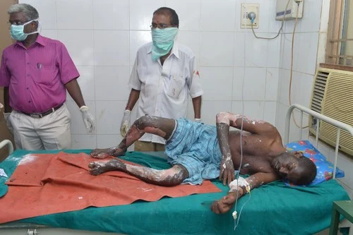 நடை பிணங்களாய் நடமாடும் பட்டாசு ஆலை தொழிலாளர்கள் - நெஞ்சை பிழியும் விருதுநகர் அவலம்