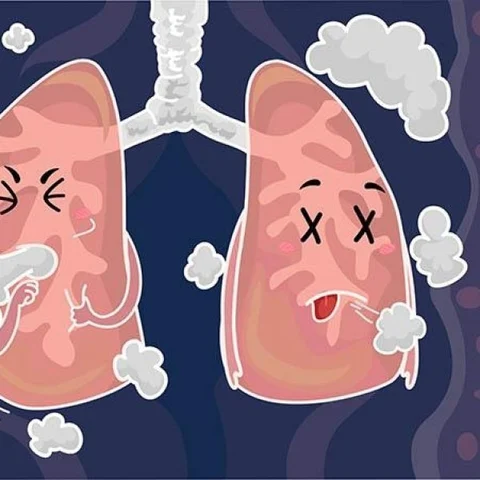 புகைபிடிப்பவர்களைக் குறிவைக்கும் நுரையீரல் தழும்பு நோய்! #PulmonaryFibrosis #PFAwarenessMonth