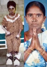 நடை பிணங்களாய் நடமாடும் பட்டாசு ஆலை தொழிலாளர்கள் - நெஞ்சை பிழியும் விருதுநகர் அவலம்