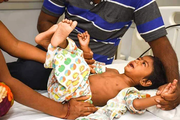 2 வயதுக் குழந்தைக்கு 3 அறுவை சிகிச்சைகள்...