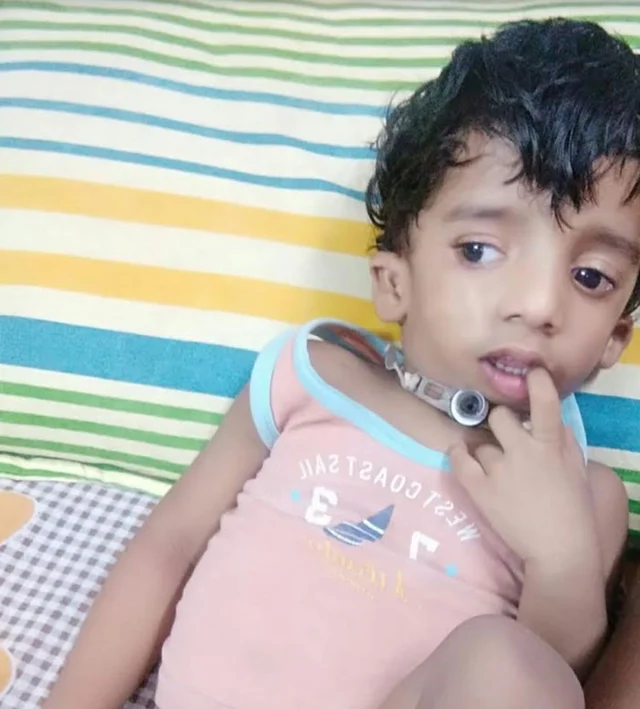 இந்தக் குழந்தைக்கு ஏன் இப்படிப்பட்ட ஒரு கொடுமையான நோய்? #NeedHelp