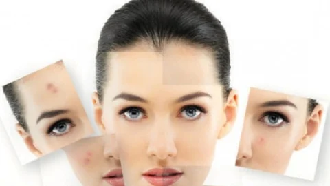 #SkinCareTips