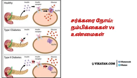 சர்க்கரை நோய்: நம்பிக்கைகள் Vs உண்மைகள்