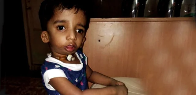 இந்தக் குழந்தைக்கு ஏன் இப்படிப்பட்ட ஒரு கொடுமையான நோய்? #NeedHelp