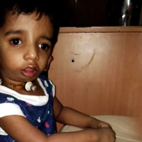 இந்தக் குழந்தைக்கு ஏன் இப்படிப்பட்ட ஒரு கொடுமையான நோய்? #NeedHelp