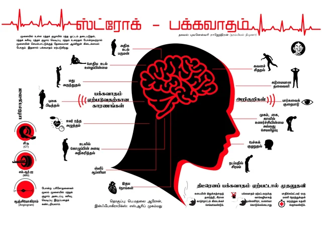 `புகைபிடிப்பவர்களுக்கு இரண்டாவது முறை 'ஸ்ட்ரோக்' ஏற்பட வாய்ப்புகள் அதிகம்!' - எச்சரிக்கும் புதிய ஆய்வு