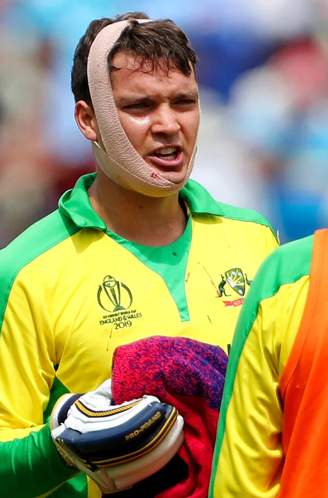 Australia's Alex Carey talks to teammate Adam Zampa during a drinks break after he was hit off the bowling of England's Jofra Archer.
