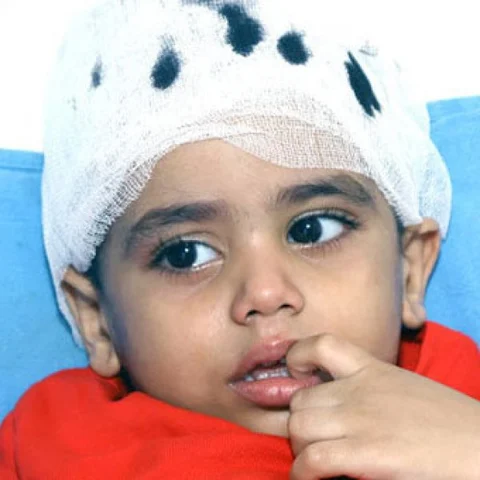 மூன்று வயது குழந்தையை வதைக்கும் மூளை நோய்! #SaveShaker
