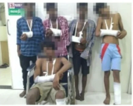 வழுக்கி விழுந்ததில் கை உடைந்த மாணவர்கள்