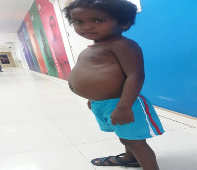 தாயின் கல்லீரல் இருக்கிறது, ஆபரேஷனுக்கு பணம்தான் இல்லை!