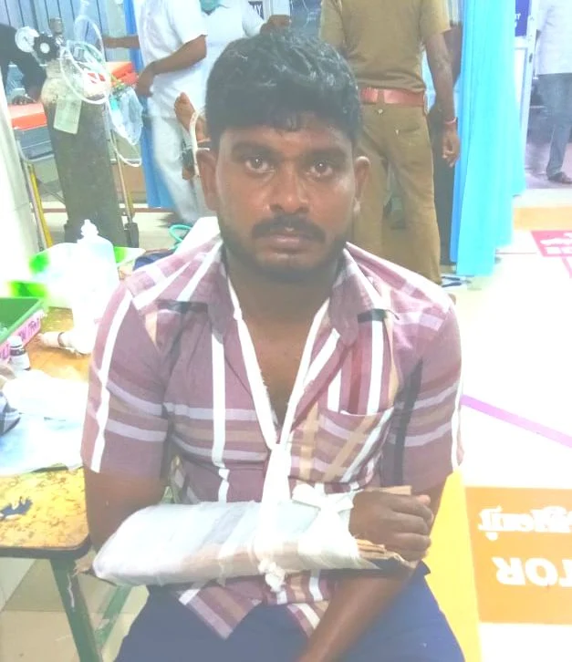 கையில் மாவு கட்டுடன் கொள்ளையன்