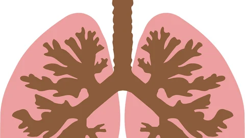 Tuberculosis