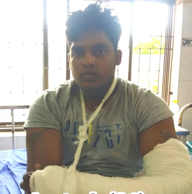 கை முறிந்து சிகிச்சை பெறும் கொள்ளையர்