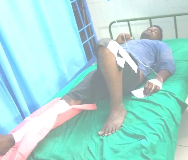 கால் முறிந்து சிகிச்சை பெறும் கொள்ளையன்