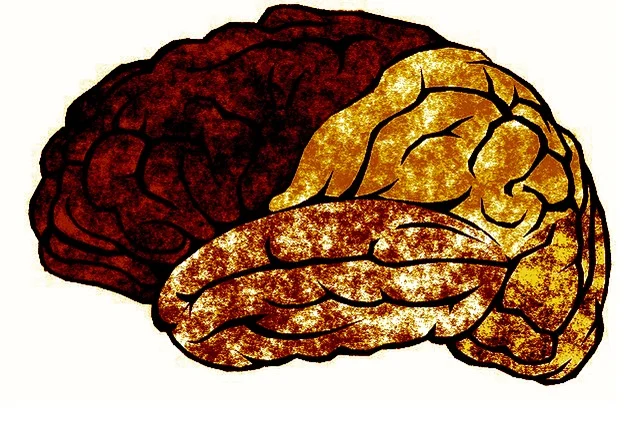 Brain death