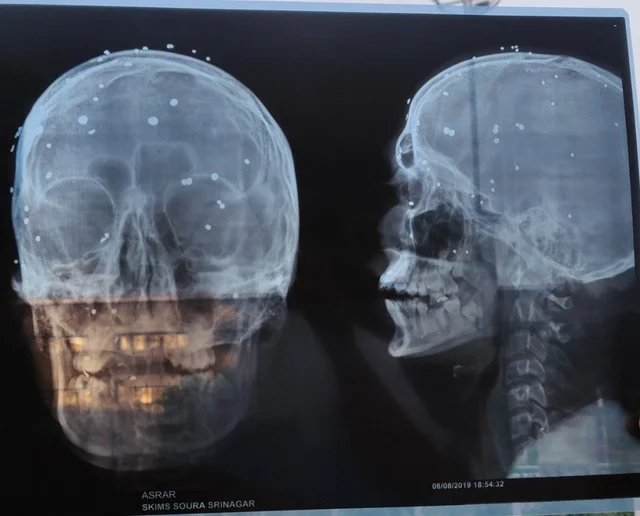 Asar X-Ray Report