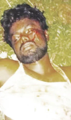 இளைஞர்களால் தாக்கப்பட்டவர்