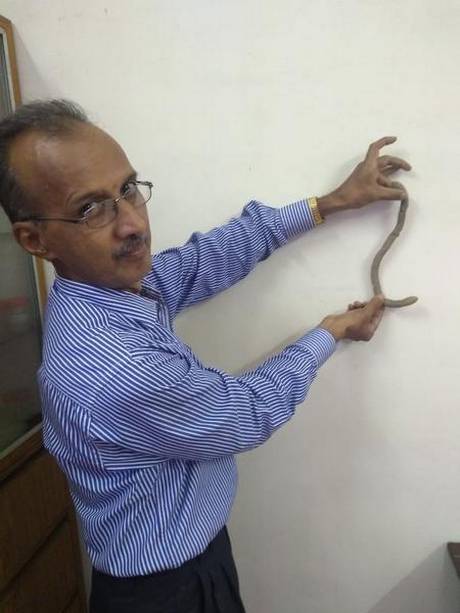 950 மி.மீ நீள ராட்சத மண்புழு! - அச்சமடைந்த விவசாயத் தொழிலாளிகள்