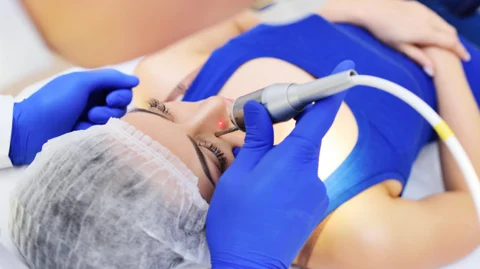 Cauterization