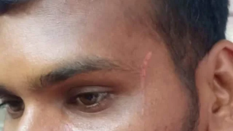 தாக்கப்பட்ட காளிமுத்து