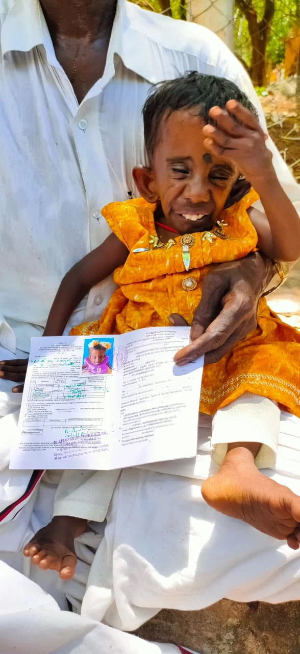 மாற்றுத்திறனாளி குழந்தை