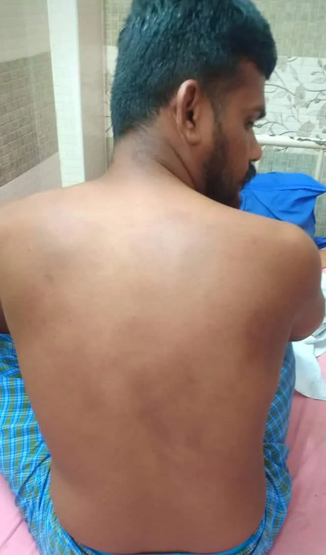 தாக்கப்பட்ட காளிமுத்து