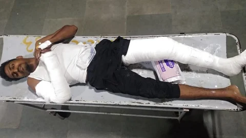 Police Breaking accused hand anda leg