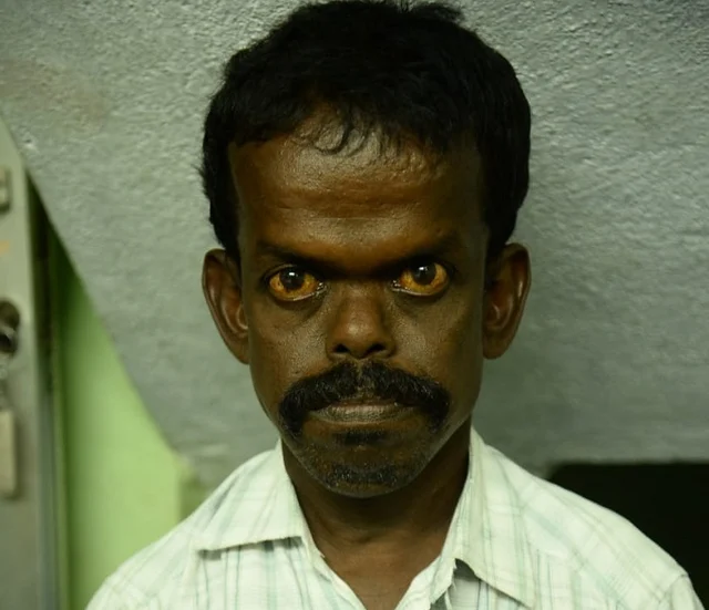 மாற்றுத்திறனாளி ஜோசப்