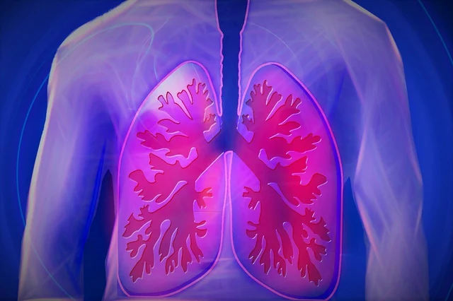 Pulmonary embolism