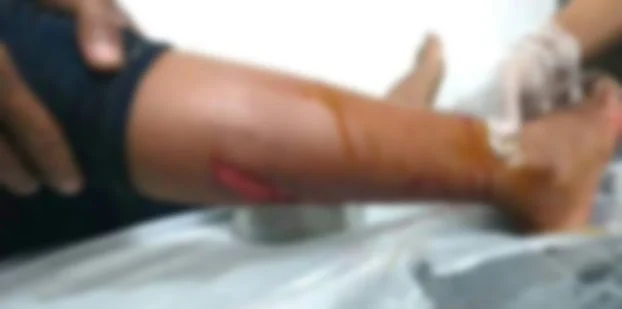 ஹைனா