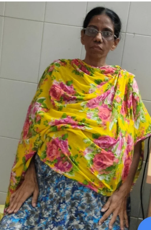 சிகிச்சைக்கு முன் ரதி.