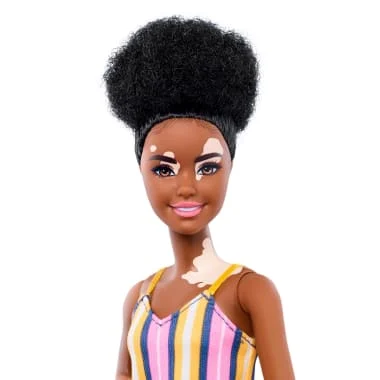 Barbie with Vitiligo