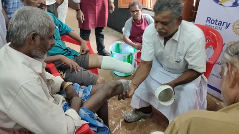 செயற்கைக் கால்கள் தாயாரிக்க அளவெடுக்கும் பணி