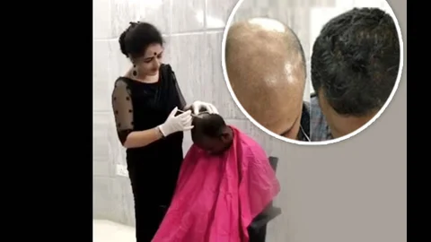 தலைமுடி