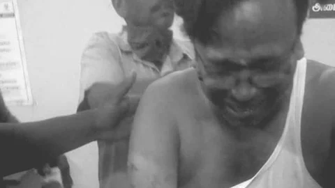 வெட்டுக் காயங்களுடன் பகவான் நந்து
