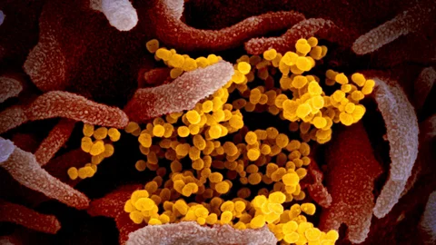 Novel Coronavirus SARS-CoV-2