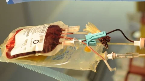 Plasma treatment