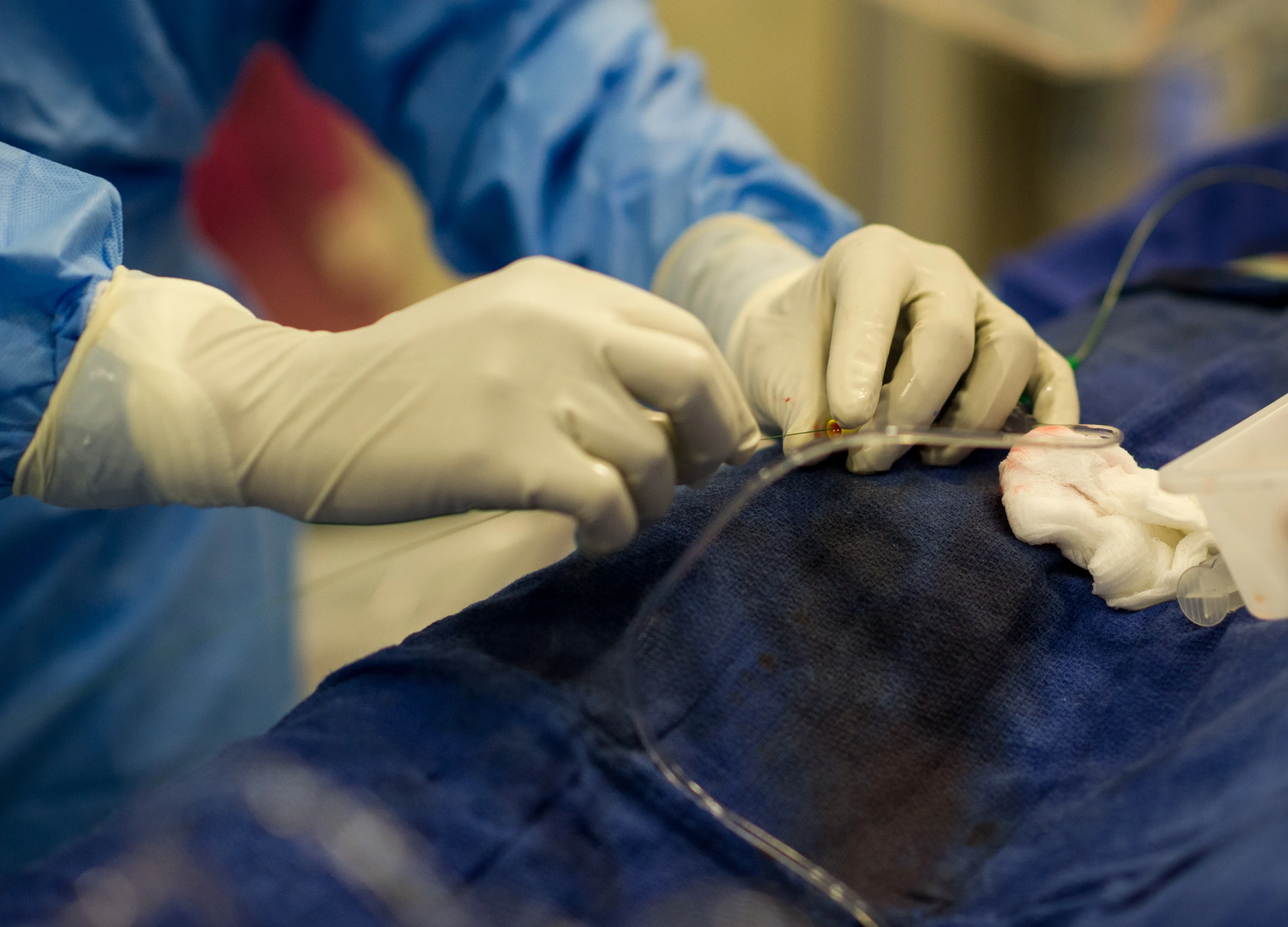 NPPA Exempts Meril Life Science’s Stents From Price Control For Five Years