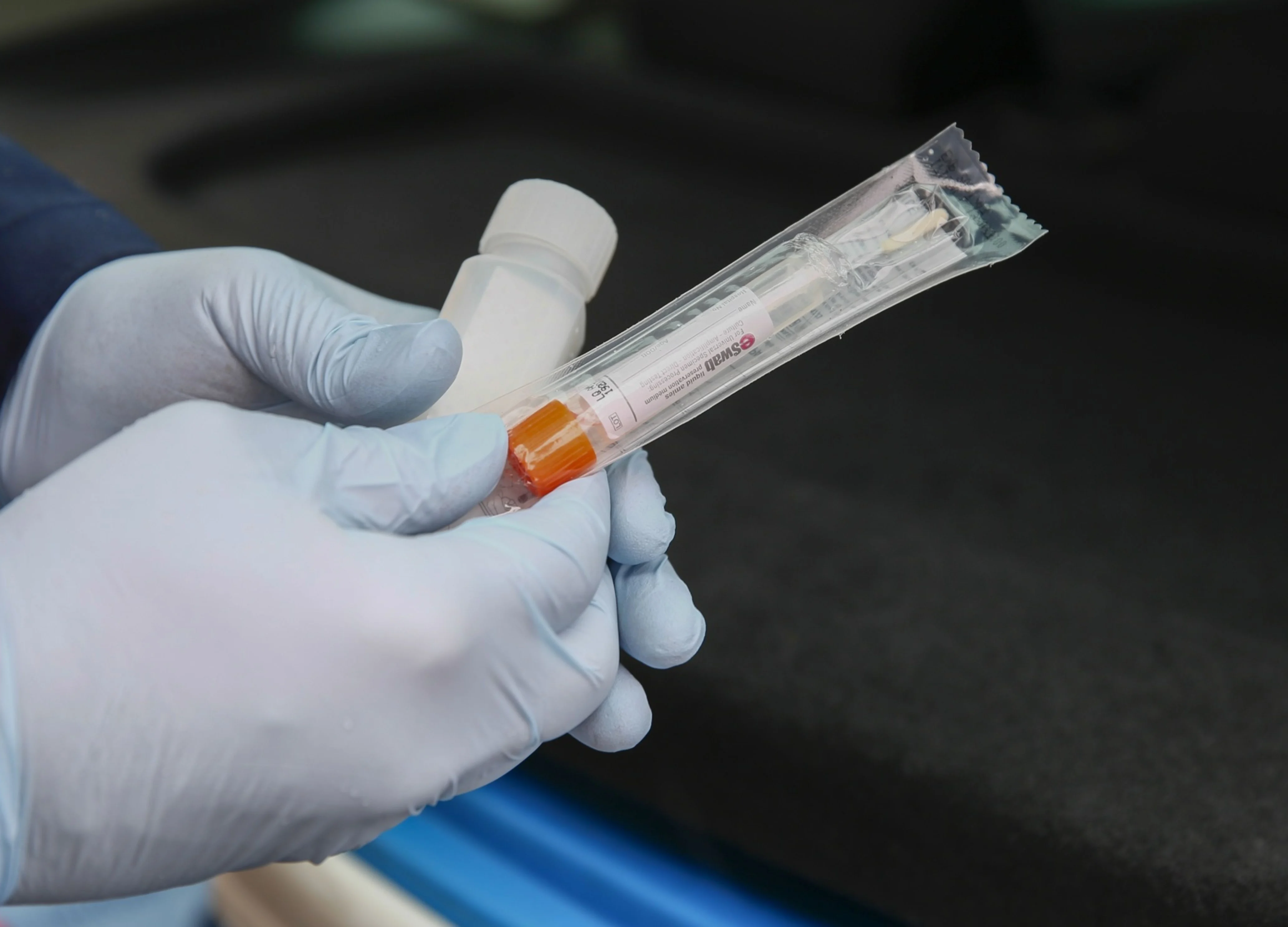 Coronavirus Testing: ICMR Sets Up Fast Track Mechanism To Validate Kits That Don’t Have U.S. FDA, EU Approvals