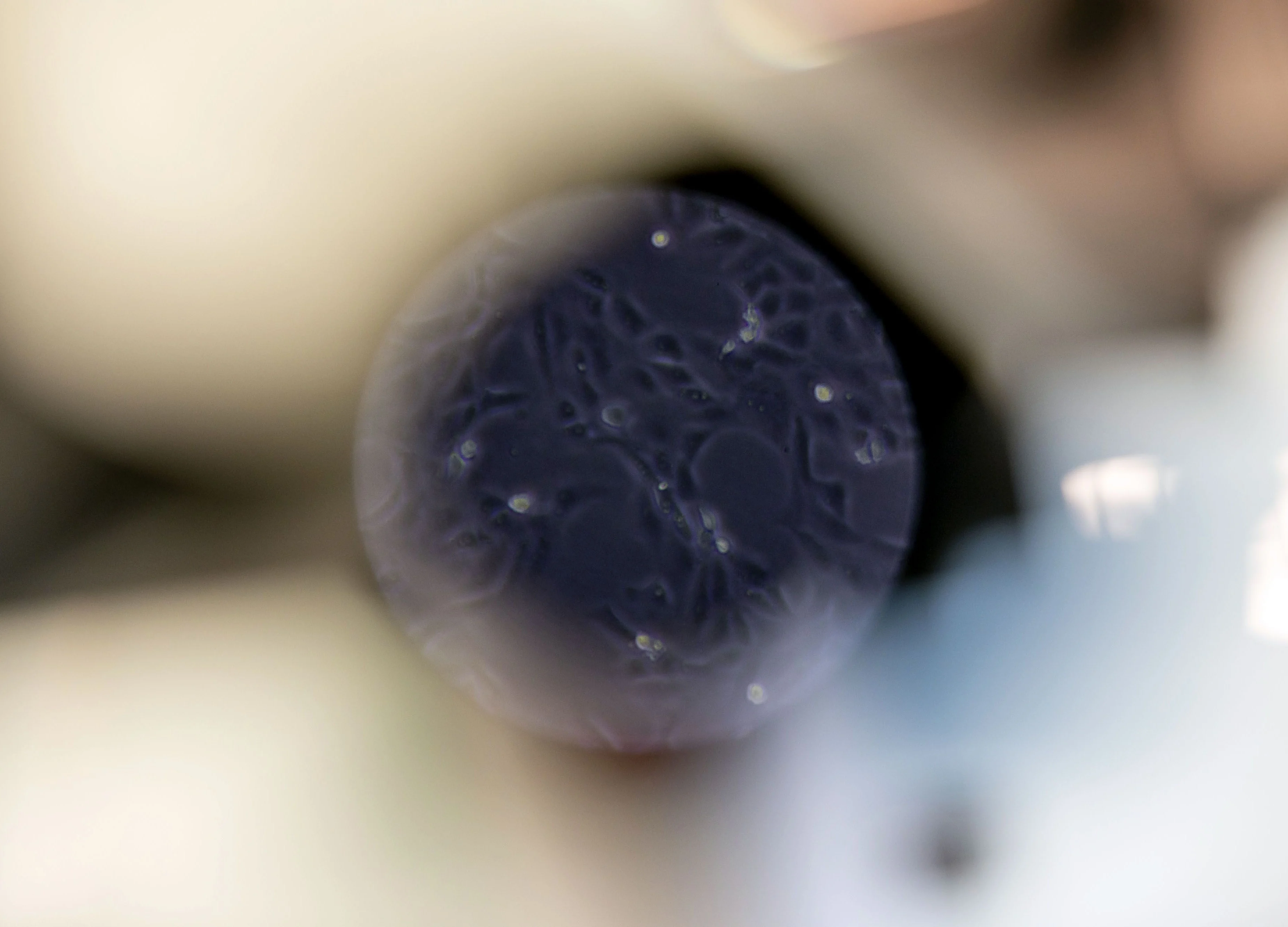 Virus Vaccine Trial, Faster Testing Are Bright Spots in Outbreak